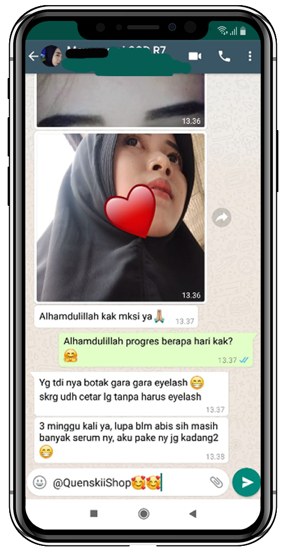 TESTI-EXALINE-11.png